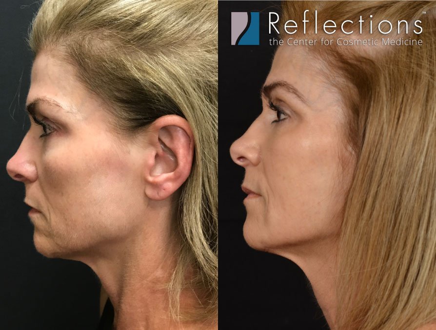 Anti-aging Treatments